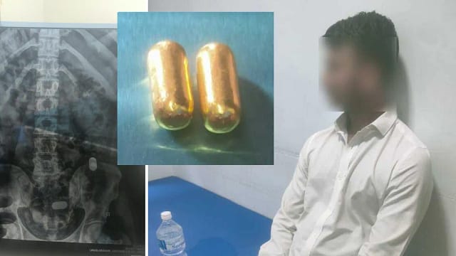 पेटभित्र लुकाएर ल्याइएको सुनसहित बंगलादेशी नागरिक पक्राउ